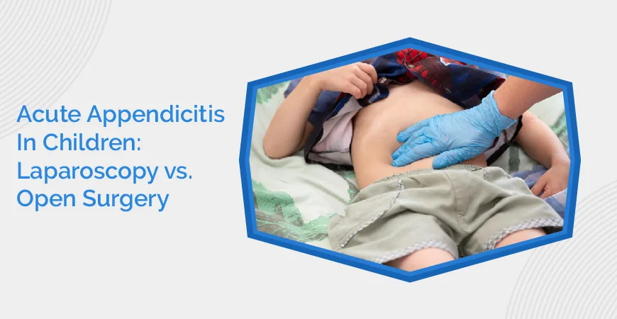 Acute Appendicitis In Children Laparoscopy Vs. Open Surgery