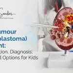 Wilms tumour treatment in children