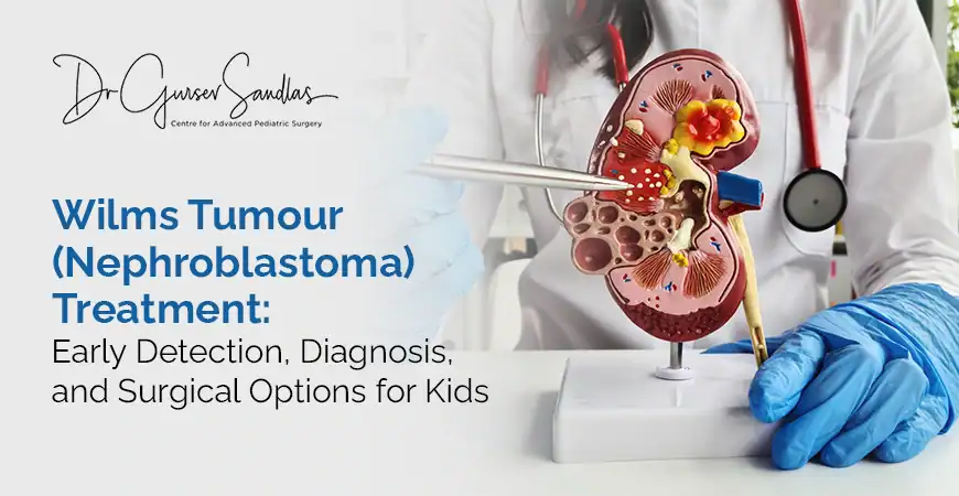 Wilms tumour treatment in children